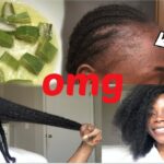 Benefits of Aloe Vera For Hair